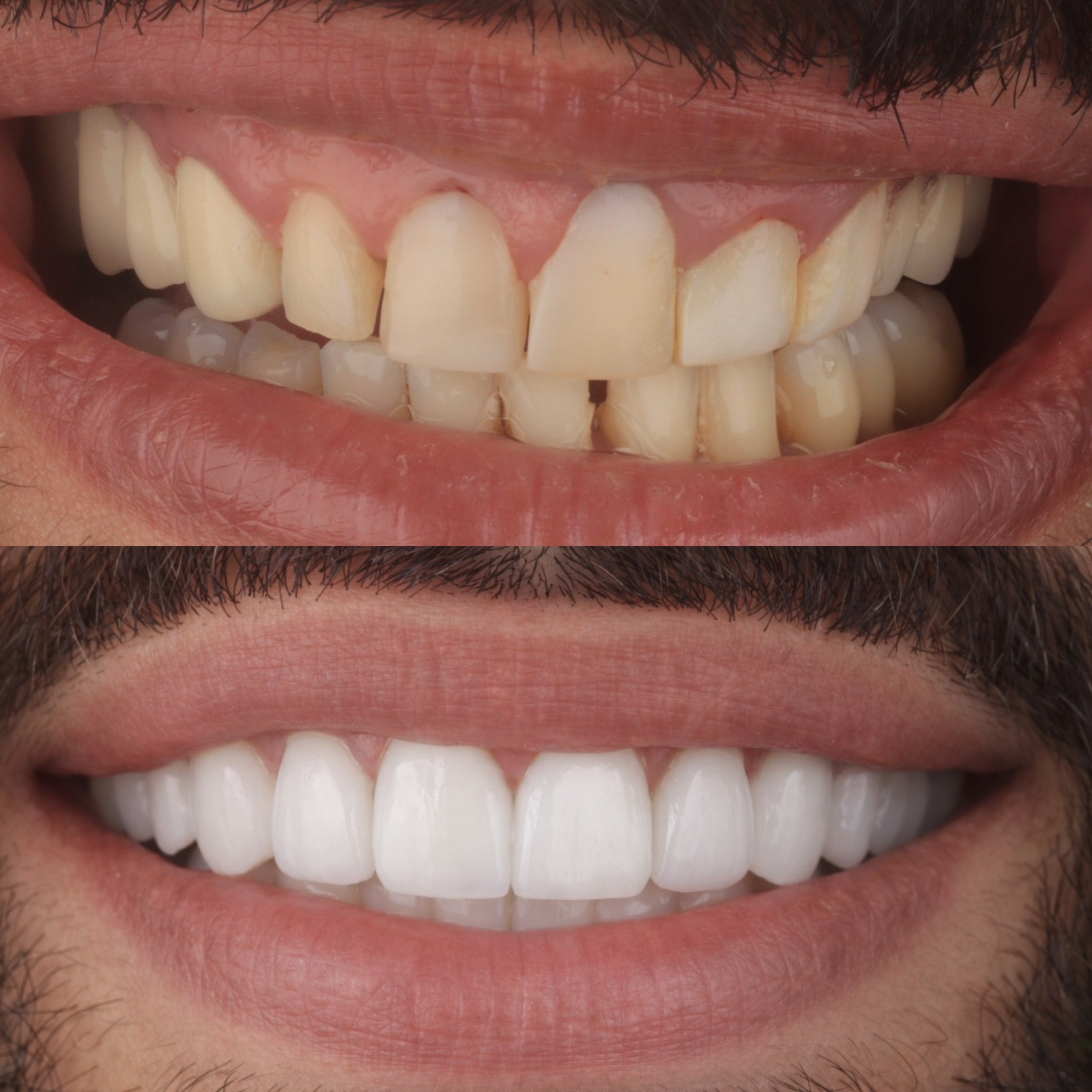 Transformación dental antes y después